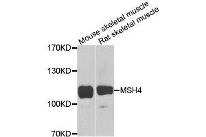 Western blot analysis of extracts of various cell lines, using MSH4 antibody (ABIN5996306) at 1/1000 dilution. (MSH4 Antikörper)