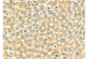 ABIN6264513 and ABIN6273302 at 1/100 staining Rat liver tissue by IHC-P.
