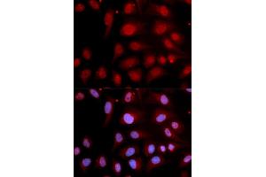 Immunofluorescence analysis of U2OS cells using POLB antibody (ABIN5970839). (POLB Antikörper)