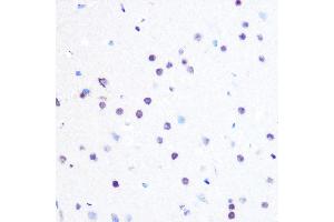 Immunohistochemistry of paraffin-embedded rat brain using PEG3 Rabbit pAb (ABIN6128527, ABIN6145434, ABIN6145435 and ABIN6216398) at dilution of 1:100 (40x lens). (PEG3 Antikörper  (AA 1-300))