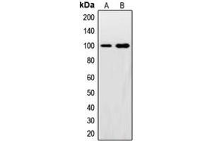 Western blot analysis of Synphilin 1 expression in HeLa (A), U2OS (B) whole cell lysates. (SNCAIP Antikörper  (C-Term))