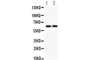 Anti- SLC22A2 Picoband antibody, Western blotting All lanes: Anti SLC22A2  at 0.