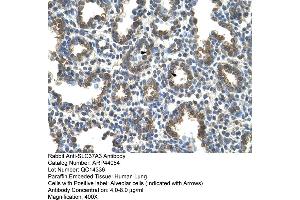 Human Lung (SLC37A3 Antikörper  (Middle Region))