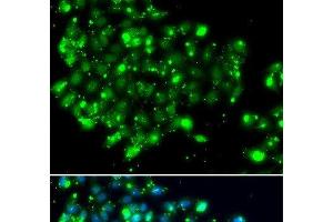Immunofluorescence analysis of MCF-7 cells using NAT9 Polyclonal Antibody (NAT9 Antikörper)