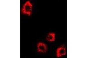 Immunofluorescent analysis of DDX58 staining in HepG2 cells.
