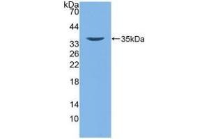 Detection of Recombinant DEFb2, Human using Polyclonal Antibody to Defensin Beta 2 (DEFb2) (beta 2 Defensin Antikörper  (AA 24-64))