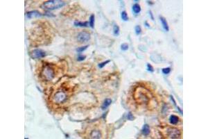 Used in DAB staining on fromalin fixed paraffin-embedded Stomach tissue (IL2RG Antikörper  (AA 23-262))