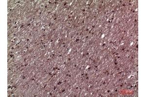 Immunohistochemical analysis of paraffin-embedded human-brain, antibody was diluted at 1:100. (HSD11B1 Antikörper  (N-Term))