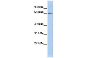 Western Blot showing ZNF619 antibody used at a concentration of 1-2 ug/ml to detect its target protein. (ZNF619 Antikörper  (N-Term))