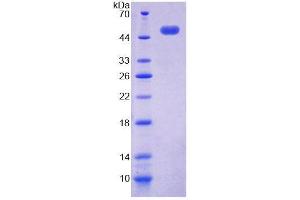 SDS-PAGE analysis of Human ACP6 Protein. (ACP6 Protein)