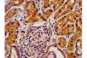 IHC image of ABIN7157473 diluted at 1:500 and staining in paraffin-embedded human kidney tissue performed on a Leica BondTM system. (CRYM Antikörper  (AA 169-258))