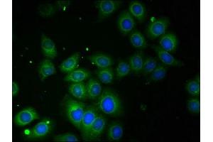 Immunofluorescent analysis of A549 cells using ABIN7142715 at dilution of 1:100 (TROVE2 Antikörper  (AA 3-535))