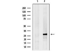 Western blot analysis of lysates from EC304, using EIF4E3 Antibody.