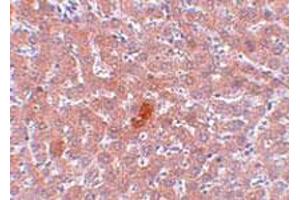 Immunohistochemical staining of rat liver tissue with 5 ug/mL KDM3A polyclonal antibody . (KDM3A Antikörper  (N-Term))