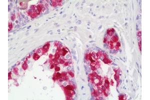 Anti-MEN1 / MENIN antibody IHC staining of human prostate.