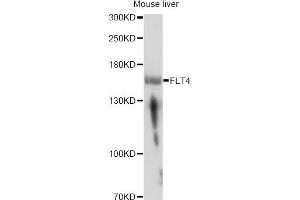 Western blot analysis of extracts of mouse liver, using FLT4 antibody. (FLT4 Antikörper)