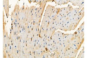 ABIN6257390 and ABIN6273800 at 1/100 staining Mouse heart tissue by IHC-P. (NRK Antikörper  (N-Term))
