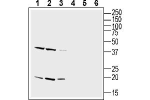 Western blot analysis of rat brain lysate (lanes 1 and 4), mouse brain lysate (lanes 2 and 5) and mouse liver lysate (lanes 3 and 6):1-3. (CD81 Antikörper  (Extracellular))