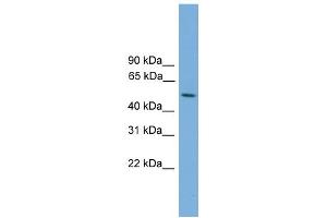 WB Suggested Anti-STK38L Antibody Titration: 0. (STK38L Antikörper  (Middle Region))