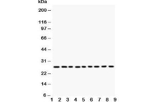 Western blot testing of Kallikrein 6 antibody and Lane 1:  MCF-7;  2: HeLa;  3: MM231;  4: MM453;  5: A549;  6: SMMC-7721;  7: COLO320;  8: SW620;  9: HT1080 (Kallikrein 6 Antikörper  (C-Term))