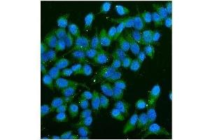 IF analysis of CD59 using anti-CD59 antibody (ABIN7600941).