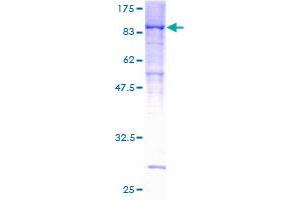 Image no. 1 for Protein Phosphatase 2, Regulatory Subunit B', delta (PPP2R5D) (AA 1-602) protein (GST tag) (ABIN1316058) (PPP2R5D Protein (AA 1-602) (GST tag))