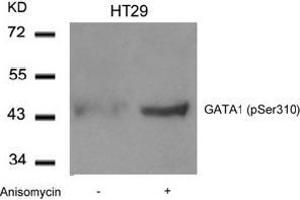 Image no. 2 for anti-GATA Binding Protein 1 (Globin Transcription Factor 1) (GATA1) (pSer310) antibody (ABIN196686) (GATA1 Antikörper  (pSer310))