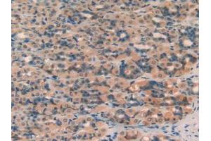 Figure. (SERPINA7 Antikörper  (AA 114-391))