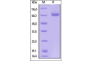 SDS-PAGE (SDS) image for CD38 (AA 43-300) (Active) protein (Fc Tag) (ABIN6253673)