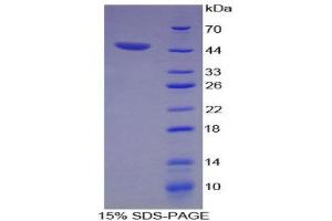 SDS-PAGE (SDS) image for Aquaporin 4 (AQP4) (AA 179-314) protein (His tag,GST tag) (ABIN1879479)