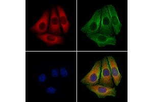 ABIN6257952 and ABIN6274275 staining Hela cells by IF/ICC. (BCAP31 Antikörper  (C-Term))