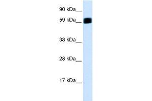 WB Suggested Anti-EIF2AK2 Antibody Titration:  0. (EIF2AK2 Antikörper  (C-Term))