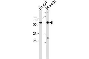 Western Blotting (WB) image for anti-Retinoic Acid Receptor, alpha (RARA) antibody (ABIN2997575) (Retinoic Acid Receptor alpha Antikörper)