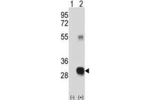 Western Blotting (WB) image for anti-CAAX Prenyl Protease 2 (RCE1) antibody (ABIN3001522)