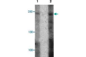 Western blot analysis of 293 cell lysate with ABCA7 polyclonal antibody  at (1) 1 and (2) 2 ug/mL.
