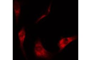 ABIN6274506 staining Hela cells by IF/ICC. (NT5C3 Antikörper  (N-Term))