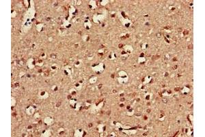 Immunohistochemistry of paraffin-embedded human brain tissue using ABIN7161085 at dilution of 1:100 (CD94 Antikörper  (AA 42-168))