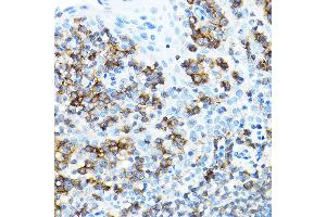 Immunohistochemistry of paraffin-embedded human tonsil using CD27 Rabbit pAb (ABIN3022680, ABIN3022681, ABIN3022682 and ABIN6219092) at dilution of 1:100 (40x lens). (CD27 Antikörper  (AA 20-191))