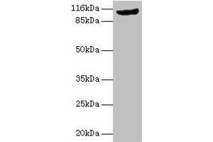 Western blot All lanes: MVP antibody at 2 μg/mL + Rat lung tissue Secondary Goat polyclonal to rabbit IgG at 1/10000 dilution Predicted band size: 100 kDa Observed band size: 110 kDa (MVP Antikörper  (AA 2-893))