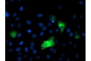 Anti-DPP9 mouse monoclonal antibody (ABIN2455319) immunofluorescent staining of COS7 cells transiently transfected by pCMV6-ENTRY DPP9 (RC224465). (DPP9 Antikörper)