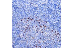 Immunohistochemistry (IHC) image for anti-NADH Dehydrogenase (Ubiquinone) 1 beta Subcomplex, 7, 18kDa (NDUFB7) (AA 1-137) antibody (ABIN6144480)