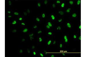 Image no. 5 for anti-Meis Homeobox 2 (MEIS2) (AA 1-382) antibody (ABIN598810) (MEIS2 Antikörper  (AA 1-382))