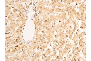 Immunohistochemistry (IHC) image for anti-Lamin A/C (LMNA) (pSer392) antibody (ABIN6256311)
