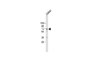 All lanes : Anti-CK2G (CK2 gma) Antibody (C-term) at 1:2000 dilution Lane 1: Jurkat whole cell lysate Lysates/proteins at 20 μg per lane. (CAMKII gamma Antikörper  (C-Term))