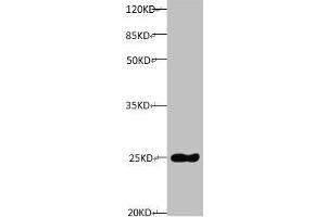 All lanes: Mouse anti-Human Timp1 monoclonal antibody at 1 μg/mL Lane 1: TIMP1 transfected pichia Yeast cell lysate Predicted band size : 23 kDa Observed band size:23 kDa (TIMP1 Antikörper)