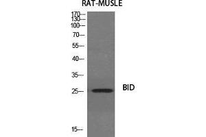 Western Blot (WB) analysis of specific cells using BID Polyclonal Antibody. (BID Antikörper  (Ser179))
