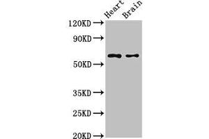 Western Blot Positive WB detected in: Mouse heart tissue, Mouse brain tissue All lanes: CYP3A4 antibody at 2. (CYP3A4 Antikörper  (AA 259-441))