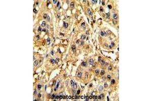 Immunohistochemistry (IHC) image for anti-Secreted Frizzled-Related Protein 5 (SFRP5) antibody (ABIN3002916) (SFRP5 Antikörper)