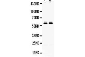 Western blot analysis of TCP1 epsilon expression in rat testis extract ( Lane 1) and HELA whole cell lysates ( Lane 2).