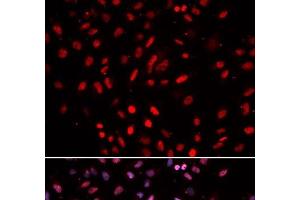 Immunofluorescence analysis of U2OS cells using POLD1 Polyclonal Antibody (POLD1 Antikörper)